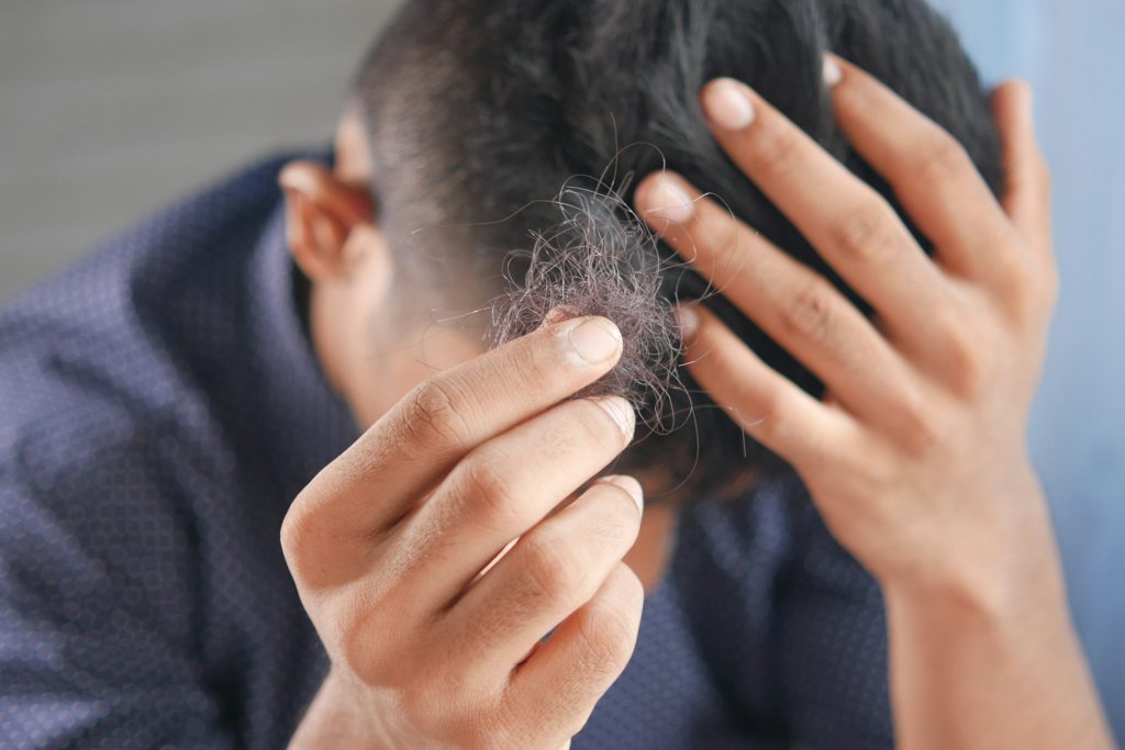 Stress e caduta dei capelli – il legame che non immaginavi