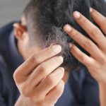 Stress e caduta dei capelli – il legame che non immaginavi