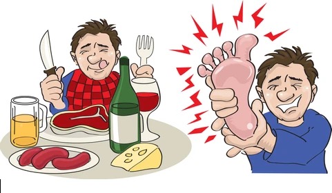 Alimenti ricchi di purine e come influenzano la gotta