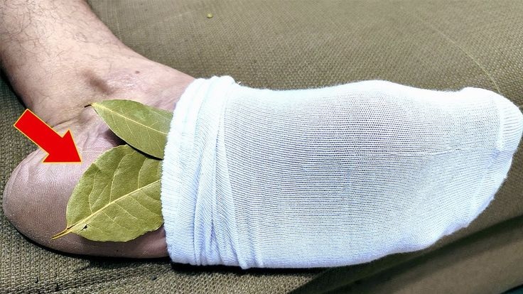 Le foglie di alloro: il rimedio inaspettato per dolori, circolazione e stress