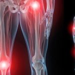 Cosa usare per i dolori articolari, senza antinfiammatori