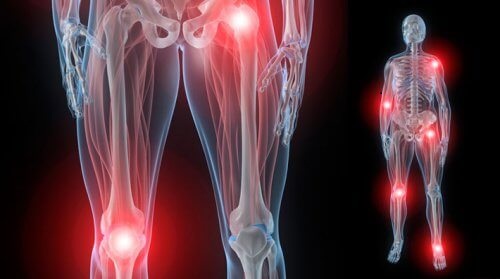 Cosa usare per i dolori articolari, senza antinfiammatori