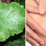 Cataplasma con foglie di bardana che i nonni usavano per il reumatismo