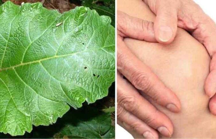 Cataplasma con foglie di bardana che i nonni usavano per il reumatismo
