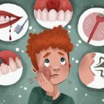 Rimedi naturali per il dolore ai denti e alle gengive