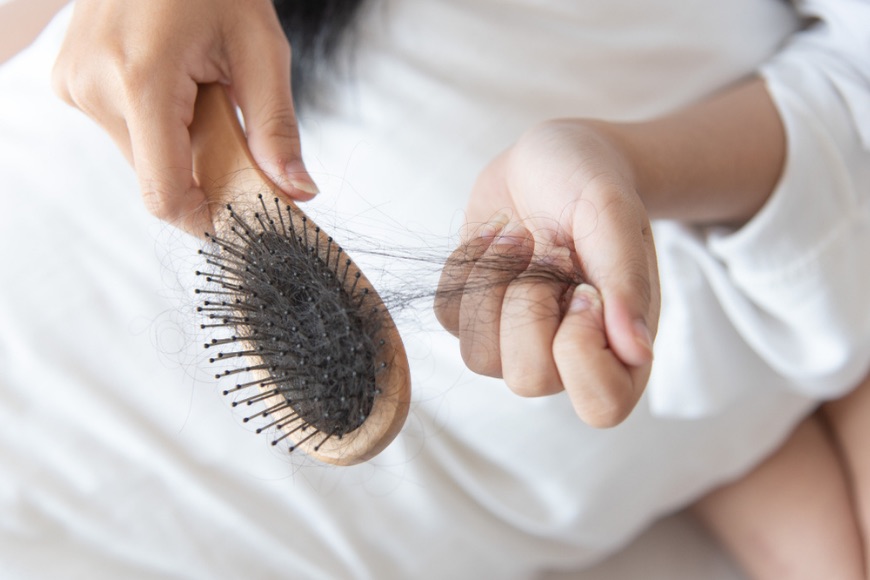 Le cause della caduta dei capelli e dell’aumento di peso nelle donne