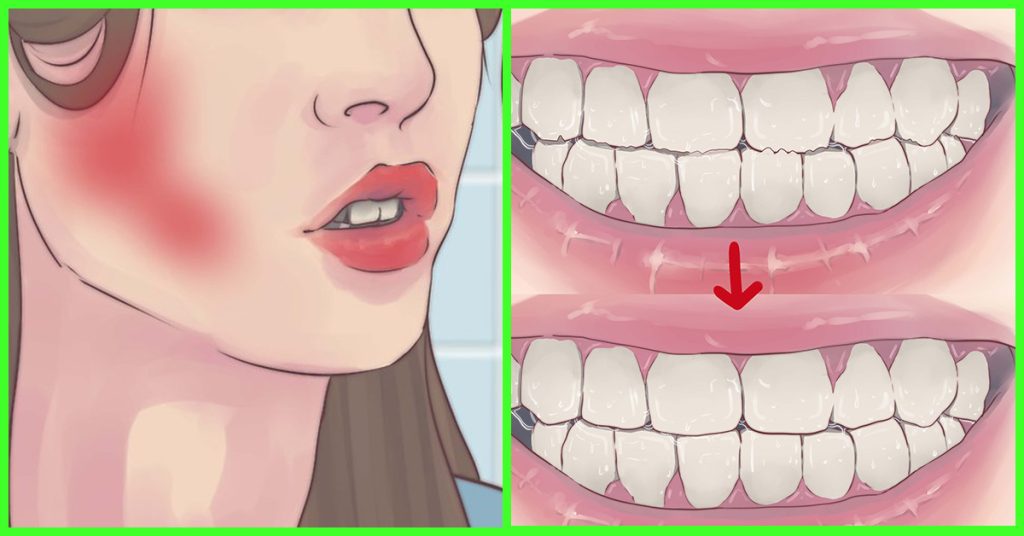 Come smettere di digrignare i denti nel sonno