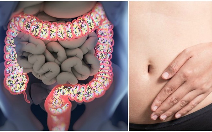 CUR di 3 giorni per un COLON sano e il ripristino della MUCOSA intestinale