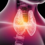 Malattia di Graves: 7 modi per aiutare a gestire i sintomi dell’ipertiroidismo