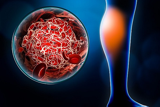 Top 5 alimenti che favoriscono la fluidificazione del sangue e riducono il rischio di coaguli