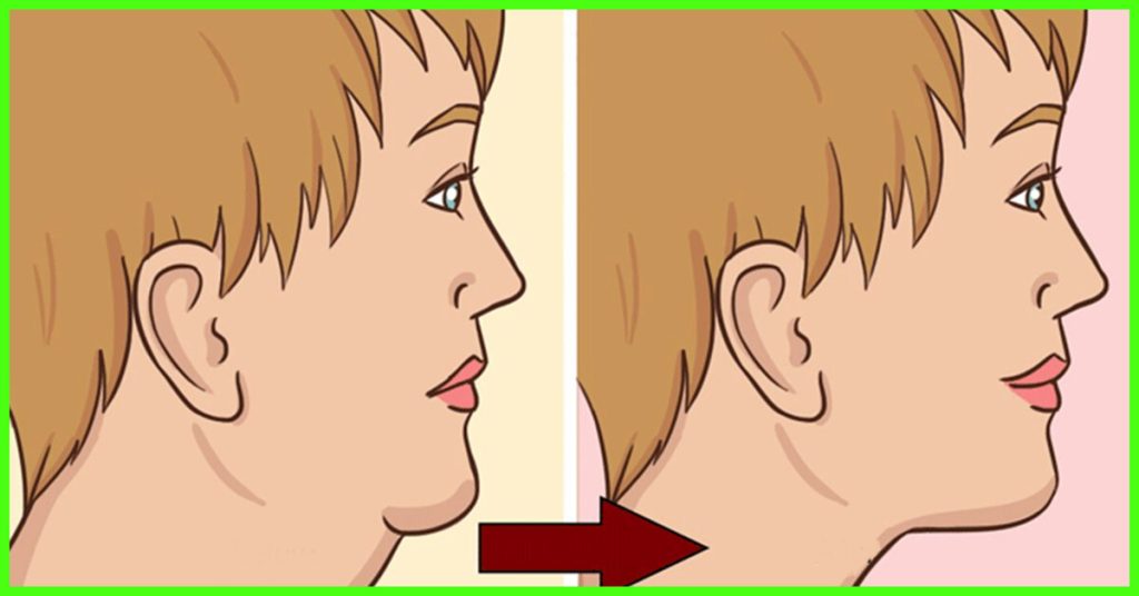 Come eliminare il doppio mento in modo naturale: 10 consigli dietetici + 5 esercizi