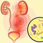 Trattare le infezioni urinarie in modo naturale: Rimedi efficaci per un comfort rapido