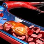 Frutti che contribuiscono alla salute dei vasi sanguigni e riducono il rischio di coaguli