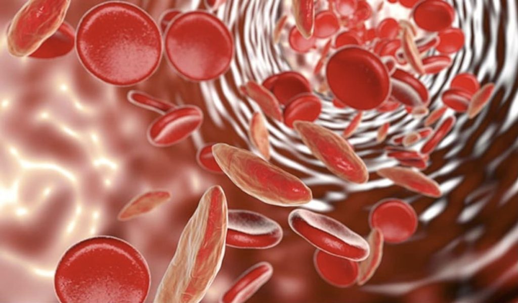 Top 21 alimenti che aumentano naturalmente il livello di emoglobina