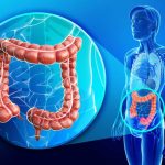 Perché e come fare una corretta pulizia del colon