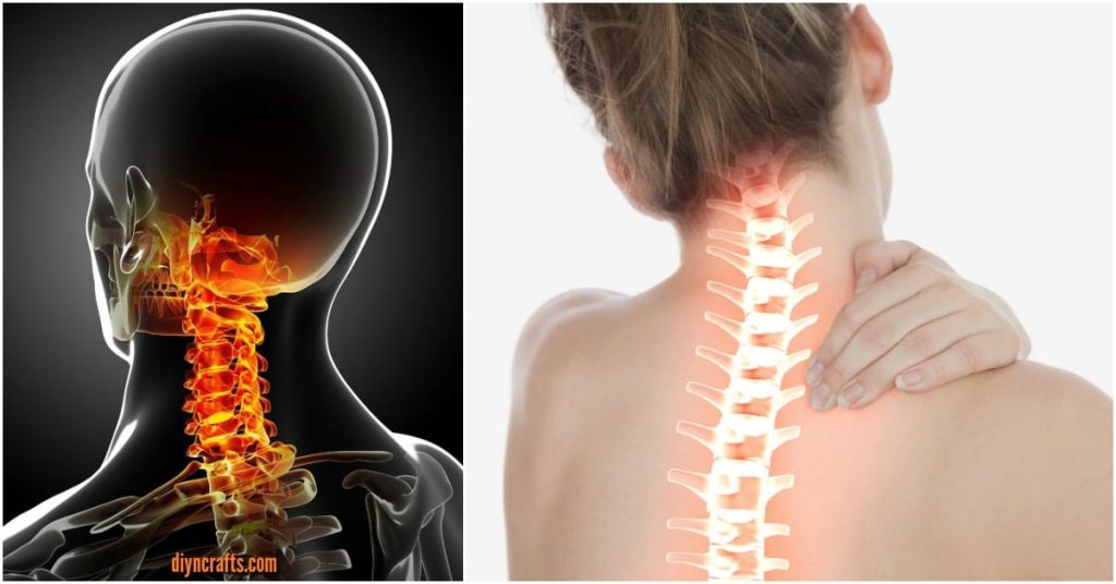 5 rimedi naturali per il collo rigido
