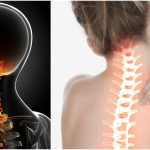 5 rimedi naturali per il collo rigido