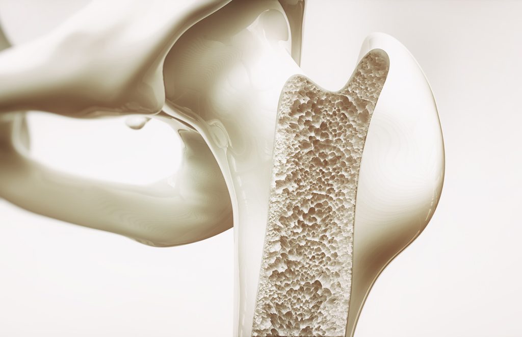 La prevenzione dell’osteoporosi inizia in cucina: Alimenti e nutrienti essenziali
