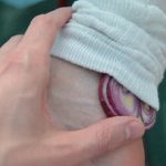 Cataplasma con cipolla, aglio e altri ingredienti: rimedio efficace per numerose affezioni