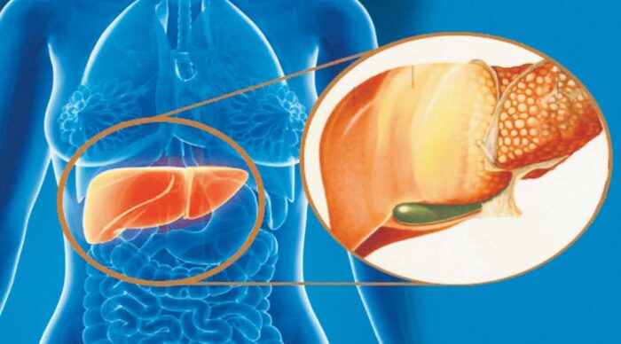 ALIMENTO GRASSO sorprendente che PROTEGGE IL FEGATO! Dr. Natalia Balan