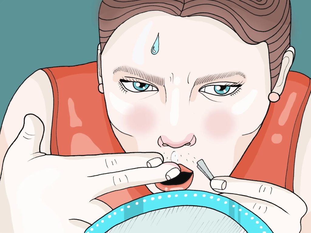 Testosterone elevato nelle donne: sintomi e rimedi naturali basati su studi