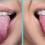 Cosa fare quando hai la lingua carica di piante che purificano il fegato e l’intestino