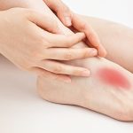 7 rimedi semplici ed efficaci per trattare i noduli ai piedi
