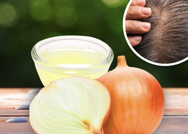 Il succo di cipolla: un rimedio potente per molti aspetti della salute, modalità di preparazione e precauzioni