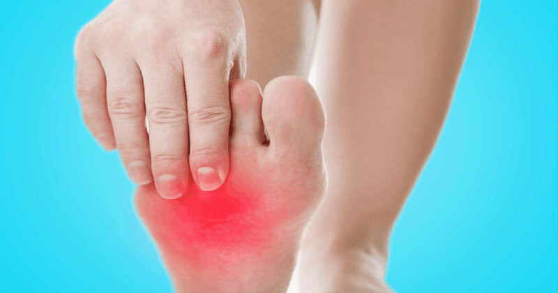 Bruciore ai piedi? Rimedi naturali e consigli medici per piedi infiammati