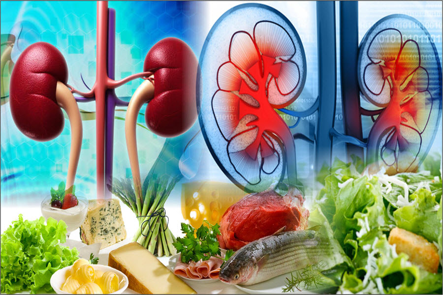 I migliori alimenti per la salute dei reni + quali alimenti evitare