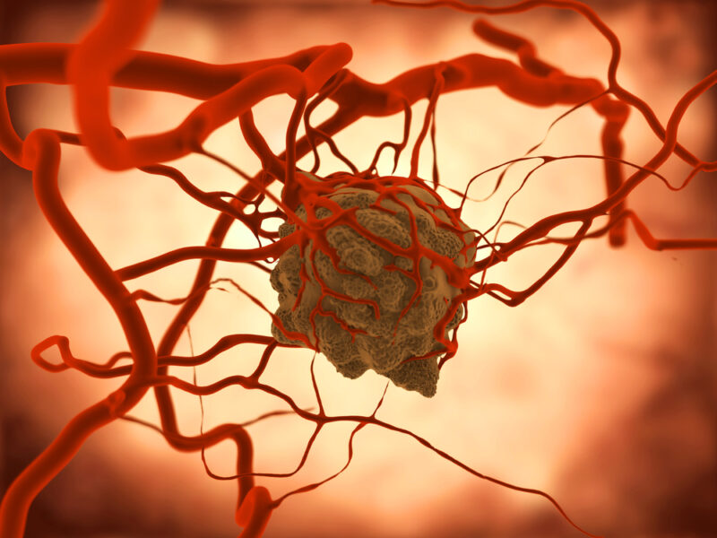 Scienziati: Questi frutti possono uccidere le cellule cancerose