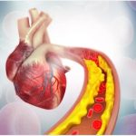 Riduci nivelul de homocisteină pentru a proteja inima și a trăi mai sănătos