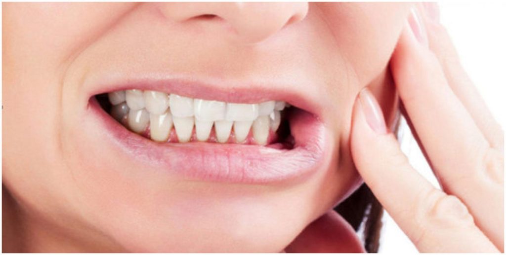 Bruxismo (digrignare dei denti) rimedi naturali e informazioni utili