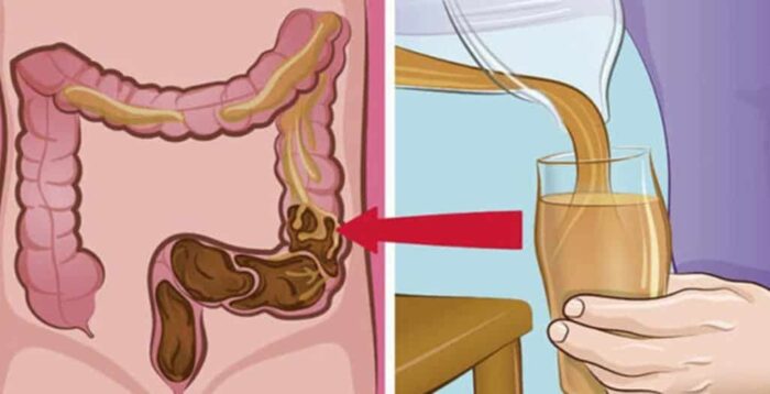 Bevanda care cură colonul eficient, fără suplimente scumpe
