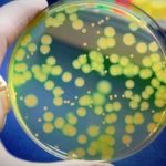 10 rimedi naturali per liberarsi di un’infezione da stafilococco + cause e sintomi
