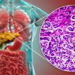 Hai il fegato sovraccarico? Ecco le piante che possono rigenerarlo naturalmente