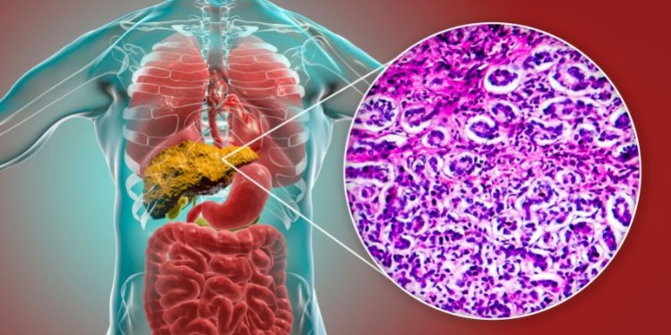 Hai il fegato sovraccarico? Ecco le piante che possono rigenerarlo naturalmente