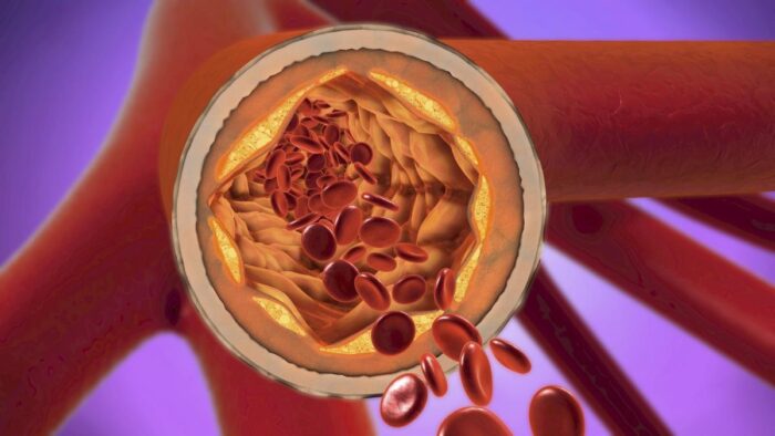 SUCCO NATURALE che ELIMINA il colesterolo e le TOXINE dal sangue! Bevi quotidianamente per arterie sane!