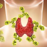 5 rimedi naturali per la salute della tiroide