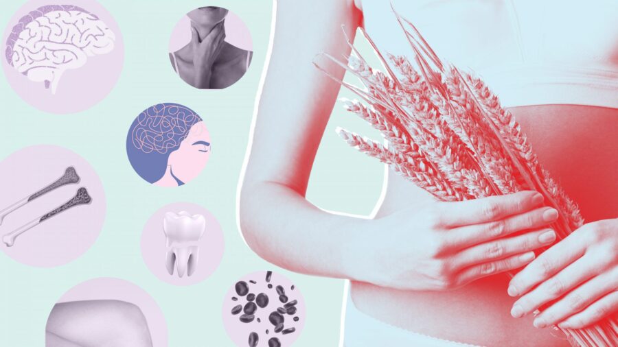 Malattia celiaca: cos’è, quali sono i sintomi e quali alimenti devono essere consumati