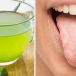 Lingua bianca (ncrcat) cause e rimedi naturali