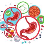 Gastrite: rimedi naturali e consigli alimentari