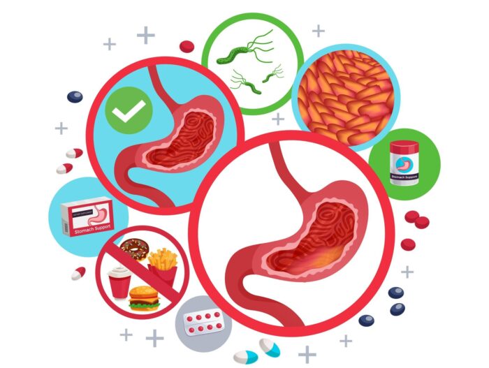 Gastrite: rimedi naturali e consigli alimentari