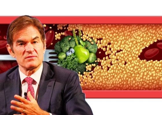 Dr. Oz rivela: 10 alimenti che combattono il colesterolo alto