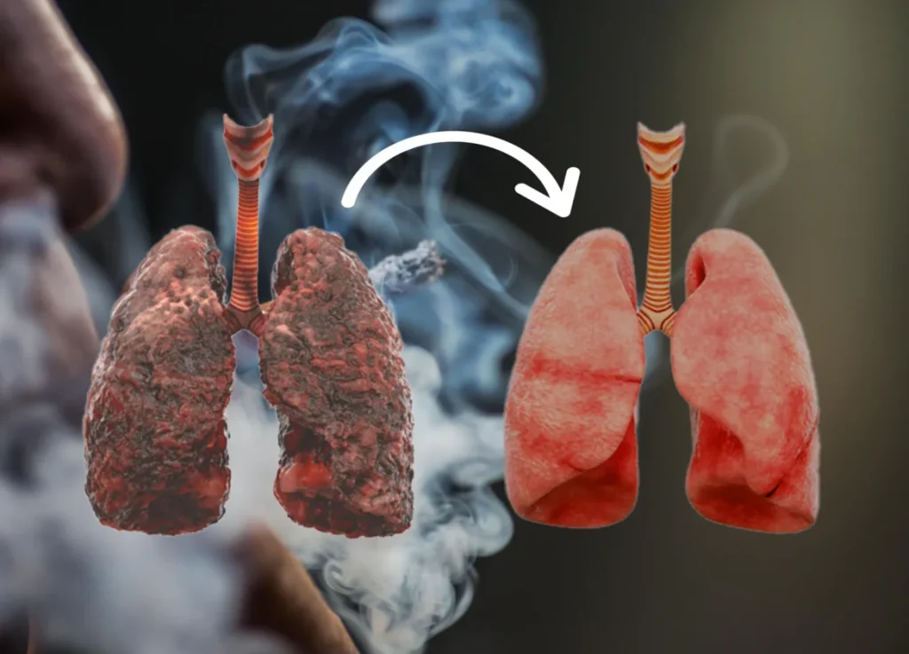 Il rimedio che purifica i polmoni anche dopo anni di fumo: ricetta e consumo