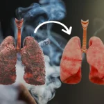 Il rimedio che purifica i polmoni anche dopo anni di fumo: ricetta e consumo