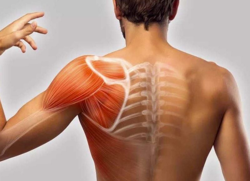 Rimedi naturali per i dolori muscolari: Ricette, applicazioni e ricerche recenti