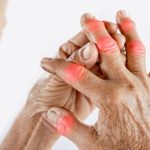 Consigli per alleviare il dolore causato dall’ARTRITE