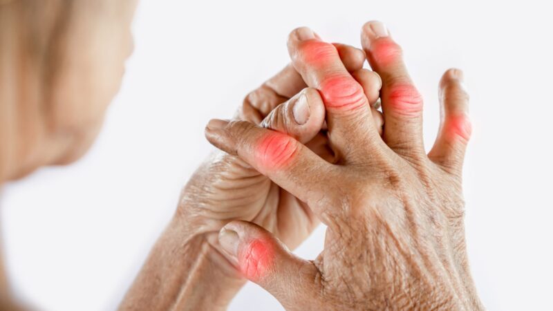 Consigli per alleviare il dolore causato dall’ARTRITE