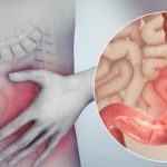 I 3 tè più efficaci per la sindrome dell’intestino irritabile